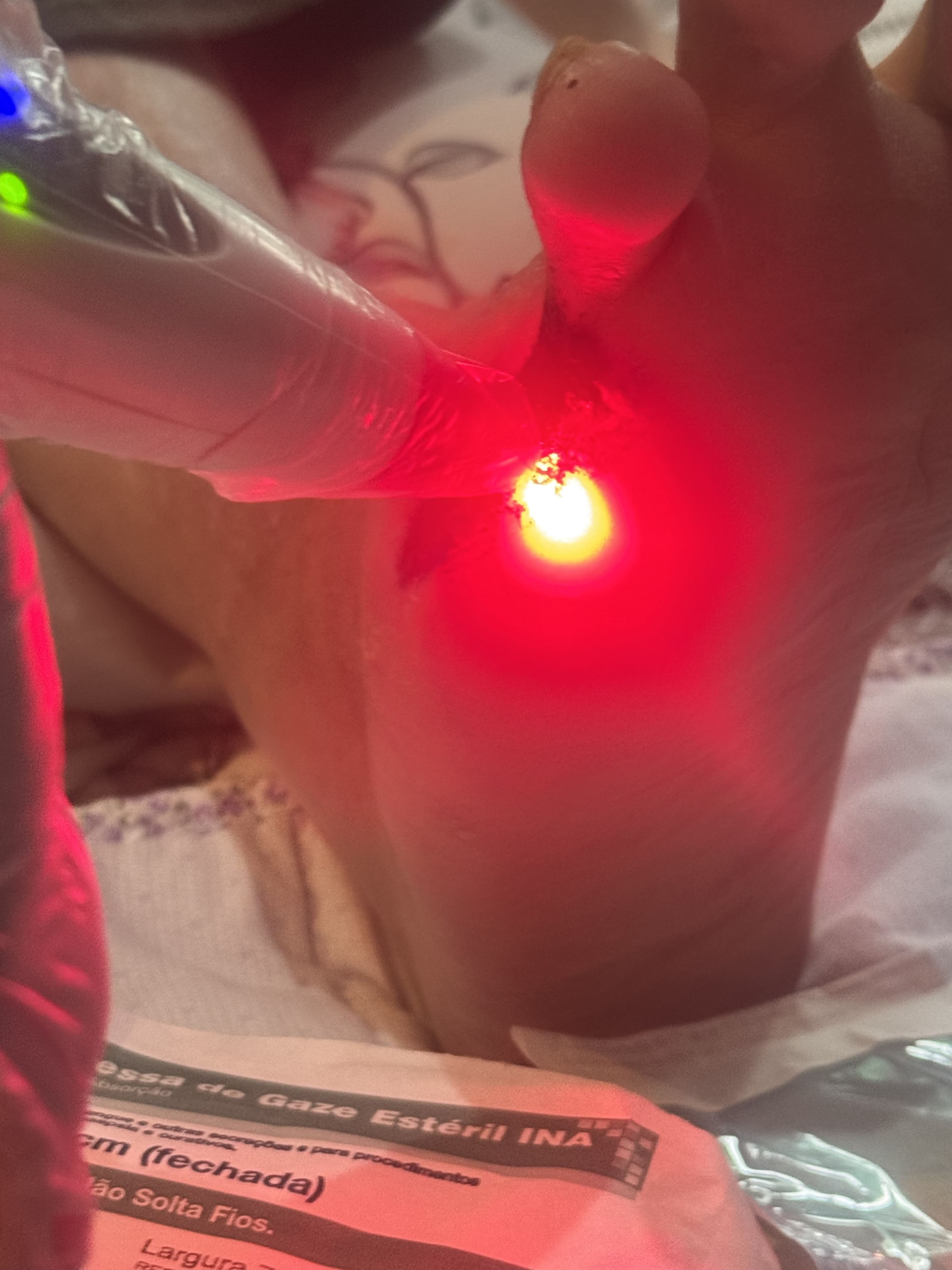 Foto do tratamento de Manejo da Dor em Feridas